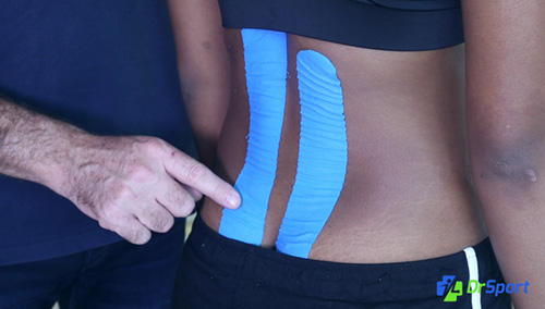 Comment réaliser un kinésio tape pour des douleurs du bas du dos ou douleurs lombaires ?